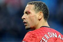 Ex England Star Ferdinand Turn Boxing Report