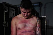 Dominik Mysterio Shows Brutal Scars After Wwe Raw Beatdown From Seth Rollins