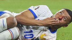 Kylian Mbappe Head Injury Didier Deschamps Concerned France Euro 