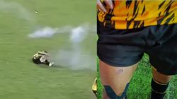 Bolivia League Player Godoy Suffers Inflammation And Burns After Firework Fans Hits Testicles Video