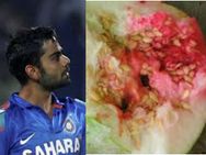 ಕೊಹ್ಲಿ ಬ್ಯಾಟಿಗೆ ಅರ್ಜೆಂಟಾಗಿ ಕುಂಬ್ಳಕಾಯಿ ಹೊಡಿ ಬೇಕಂತೆ!