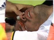 ಫುಟ್ಬಾಲ್ ದುರಂತ: ಸ್ಟಾರ್ ಆಟಗಾರನ ಕಣ್ಣಿಗೆ ತೀವ್ರ ಗಾಯ