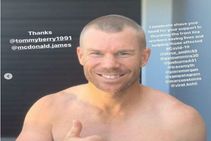 ಕೊರೊನಾ ವಿರುದ್ಧ ಹೋರಾಟ: ತಲೆ ಬೋಳಿಸಿ ಡೇವಿಡ್ ವಾರ್ನರ್ ಬೆಂಬಲ, ಕೊಹ್ಲಿಗೆ ಸವಾಲು