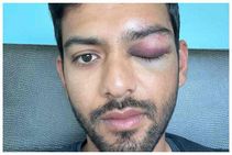 ಟೀಂ ಇಂಡಿಯಾ ಮಾಜಿ ಕ್ರಿಕೆಟಿಗ ಉನ್ಮುಕ್ತ್‌ ಚಾಂದ್‌ಗೆ ಗಂಭೀರ ಗಾಯ!