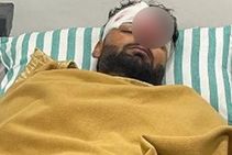 Rishabh Pant Accident: ಕಾರಿನ ಕಿಟಕಿ ಒಡೆದು ಪ್ರಾಣಾಪಾಯದಿಂದ ಪಾರಾದ ರಿಷಭ್ ಪಂತ್: 5 ಅಂಶಗಳು