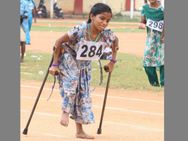 വൈകല്യങ്ങള്‍ നിങ്ങളുടെ കാഴ്ചയില്‍ മാത്രം