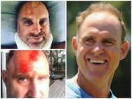 സര്‍ഫിങിനിടെ ഹെയ്ഡന് ഗുരുതര പരിക്ക്!! ചിത്രങ്ങള്‍ പുറത്ത്... ക്രിക്കറ്റ് ലോകം ഞെട്ടലില്‍