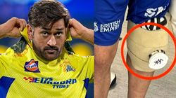 ശസ്ത്രക്രിയക്ക് വിധേയനായി ധോണി, മടങ്ങിവരവ് വൈകുമോ? അറിയാം