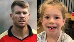 பாப்பாவுக்கு பல்லு விழுந்துருச்சு.. நீங்களும் மொட்டை அடிங்களேன்.. வீடியோ போட்ட வார்னர்