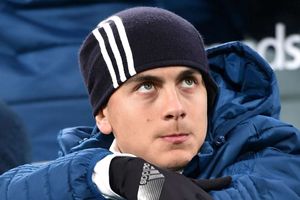 Allegri: Absolutely no problem with Dybala
