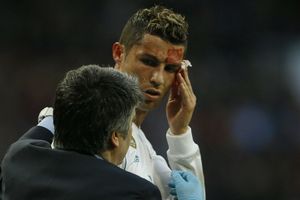 Am I still the fairest? A bleeding Ronaldo asks!
