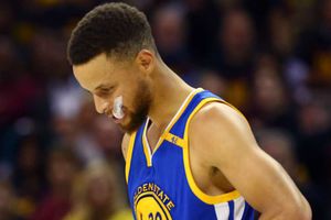 Warriors star Curry won't play first round of NBA playoffs, says Kerr