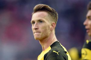 Injured Reus to miss Champions League tie against Tottenham