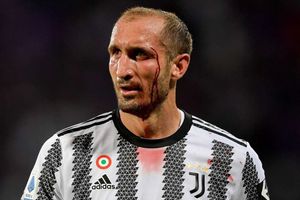 Fiorentina 2-0 Juventus: Sorry send-off for Chiellini and Dybala