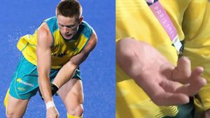 Paris Olympics: Australian field hockey star amputates finger to keep national team spot