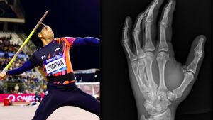 Which Hand of Neeraj Chopra Was Fractured During Brussels Diamond League Finals?