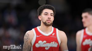 Scotty Pippen Jr. To Miss Start Of Season Due To Toe Surgery