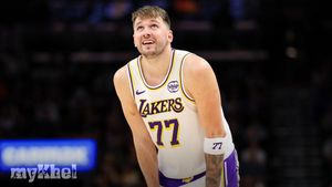 NBA Doncic Leaves Early With Leg Contusion As Lakers Fall To Clippers