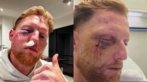 Ben Stokes Injury Update: England Star Undergoes Surgery After Training Mishap