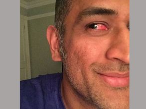 బంతి తగిలినా, సరిగా కనిపించకున్నా.. దటీజ్ ధోనీ