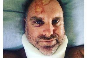 హేడెన్ నుదురుపై గాయం: అచ్చం తమిళనాడు మ్యాప్‌లా ఉందన్న జాంటీ రోడ్స్