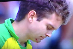 జోఫ్రా ఆర్చర్ వేసిన బౌన్సర్‌కు అలెక్స్ క్యారీ దవడ పగిలింది (వీడియో)