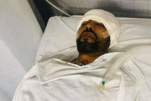 అఫ్గాన్ క్రికెటర్‌కు ఘోర రోడ్డు ప్రమాదం.. పరిస్థితి విషమం!