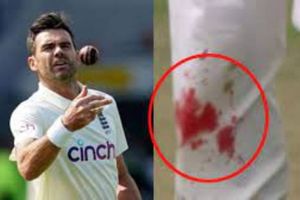 IND vs ENG: రక్తమోడుతున్నా బౌలింగ్ చేసిన ఇంగ్లండ్ పేసర్.. ఆ అంకితభావానికి హ్యాట్సాఫ్‌ అంటున్న ఫాన్స్!!