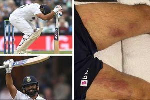 Rohit Sharma: పాపం.. తొడలు కమిలిపోయినా నొప్పితోనే సెంచరీ బాదిన హిట్ మ్యాన్!