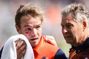 పాకిస్తాన్ బౌలర్ రాకాసి బౌన్సర్ - పగిలిన బ్యాటర్ ముఖం..!!