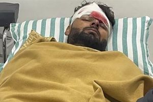 Rishabh Pant: రిషభ్ పంత్ ఆరోగ్యంపై అప్‌డేట్.. మొఖంపై గాయాలకు ప్లాస్టిక్ సర్జరీ