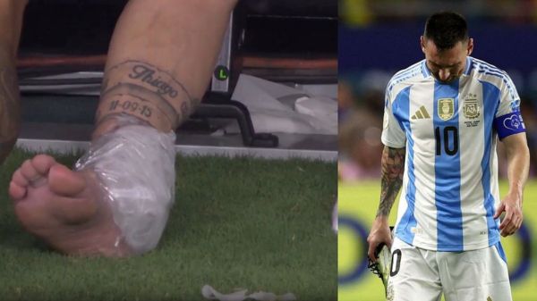lionel-messi-argentina-injury-600-1724195200 lionel-messi-argentina-injury-600-1724195200