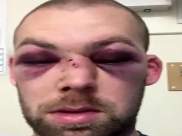 പന്ത് കൊണ്ടത് നെറ്റിയില്‍