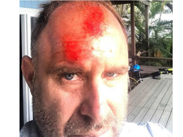 പരിക്ക് ഗുരുതരമല്ല