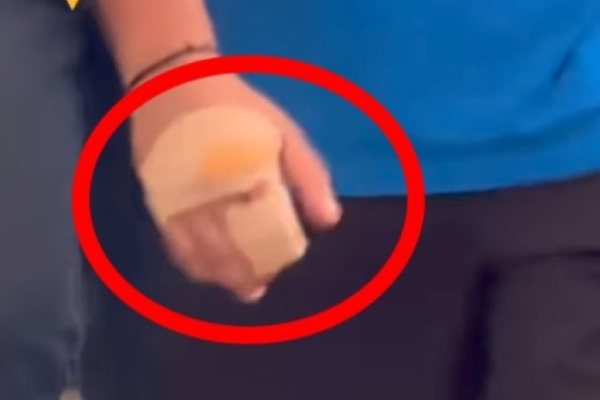 Rohit sharma playing with injured wrist during icc world cup 2023 