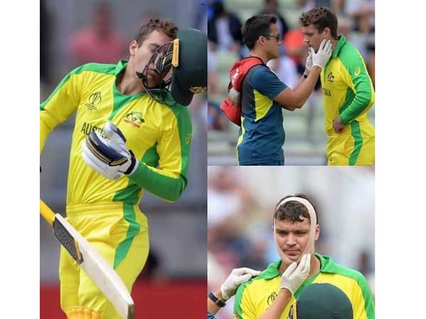 గాయంతోనే బ్యాటింగ్‌: