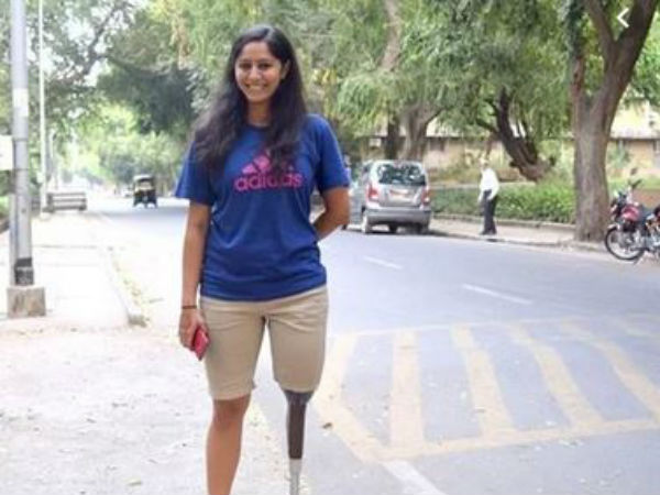 కృత్రిమ కాలుతో నడవడం