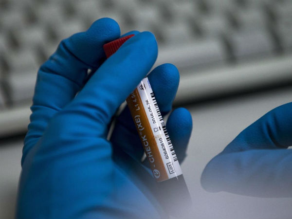 సోచి వింటర్‌ ఒలింపిక్స్‌లో 15 మంది