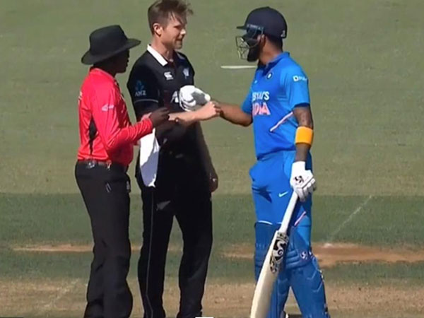  జిమ్మీ అందుకే కదా..