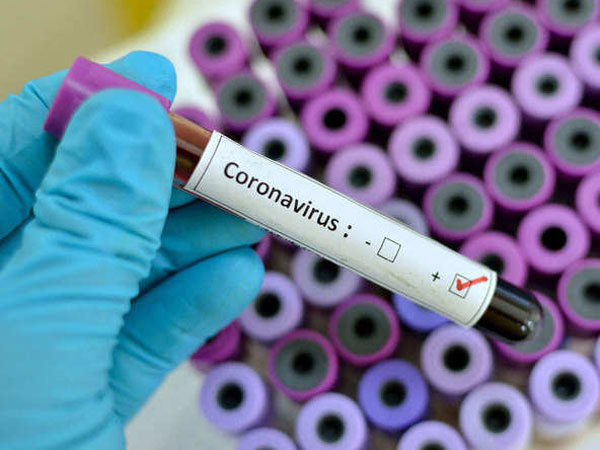 ప్ర‌తి వారం కరోనా టెస్టులు