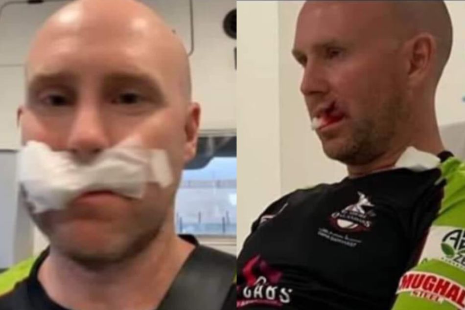 Lahore Qalandars player Ben Dunk injured during a practice session ahead of PSL 2021 Lahore Qalandars player Ben Dunk injured during a practice session ahead of PSL 2021