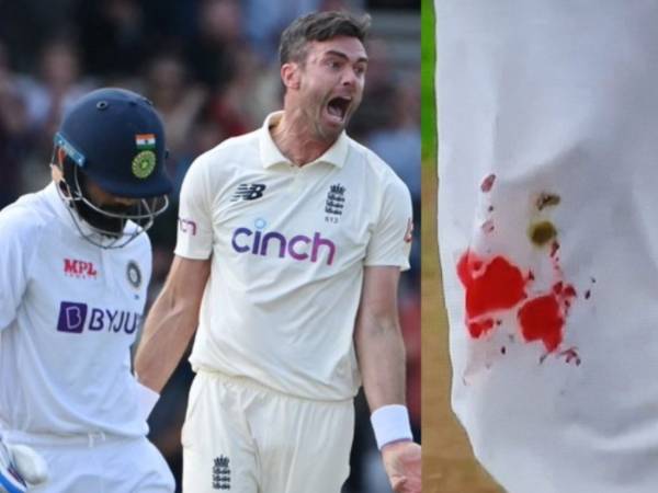  జిమ్మీ.. నీ అంకితభావానికి హ్యాట్సాఫ్‌: